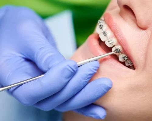 Orthodontics