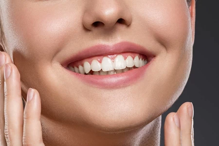 Cosmetic and treatment of the gums