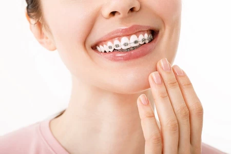 orthodontics